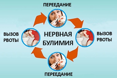 Лечение булимии в Кулешовке
